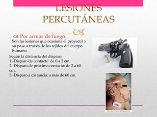  Por armas de fuego.
LESIONES
PERCUTÁNEAS
Son las lesiones que ocasiona el proyectil a
su paso a través de los tejidos del cuerpo
humano.
Según la distancia del disparo:
1.-Disparo de contacto: de 0 a 2 cm.
2.-Disparo de próximo contacto: de 2 a 60
cm.
3.-Disparo a distancia: a más de 60 cm.
 