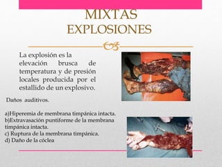 La explosión es la
MIXTAS
EXPLOSIONES
elevación brusca de
temperatura y de presión
locales producida por el
estallido de un explosivo.
Daños auditivos.
a)Hiperemia de membrana timpánica intacta.
b)Extravasación puntiforme de la membrana
timpánica intacta.
c) Ruptura de la membrana timpánica.
d) Daño de la cóclea
 
