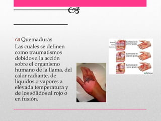 
 Quemaduras
Las cuales se definen
como traumatismos
debidos a la acción
sobre el organismo
humano de la llama, del
calor radiante, de
líquidos o vapores a
elevada temperatura y
de los sólidos al rojo o
en fusión.
 