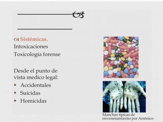 
 Sistémicas.
Intoxicaciones
Toxicología forense
Desde el punto de
vista medico legal:
 Accidentales
 Suicidas
 Homicidas
Manchas típicas de
envenenamiento por Arsénico
 
