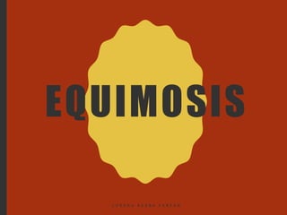 EQUIMOSIS
L O R E N A B A R B A F A R F Á N
 