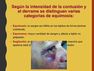 Según la intensidad de la contusión y
el derrame se distinguen varias
categorías de equimosis:
• Equimosis: la sangre se infiltra en los tejidos de forma laminar
(cardenal).
• Equimoma: mayor cantidad de sangre y afecta a tejido no
golpeado.
• Sugilación: la sangre no se infiltra, sino que la mancha que
aparece está originada por una diferencia de presión.
 