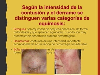 Según la intensidad de la
contusión y el derrame se
distinguen varias categorías de
equimosis:
• Petequias: son equimosis de pequeña dimensión, de forma
redondeada y que aparecen agrupadas. Cuando son muy
numerosas se denominan punteos hemorrágicos.
• Hematomas: contusión de una intensidad importante,
acompañada de acumulación de hemorragia considerable.
• Bolsa sanguínea: hematomas de mayor importancia que
forman un abultamiento sobre la piel.
 