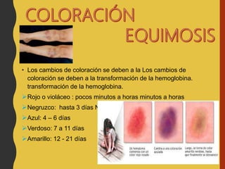 • Los cambios de coloración se deben a la Los cambios de
coloración se deben a la transformación de la hemoglobina.
transformación de la hemoglobina.
Rojo o violáceo : pocos minutos a horas minutos a horas
Negruzco: hasta 3 días Negruzco
Azul: 4 – 6 días
Verdoso: 7 a 11 días
Amarillo: 12 - 21 días
 