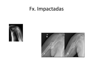 Fx. Impactadas
 