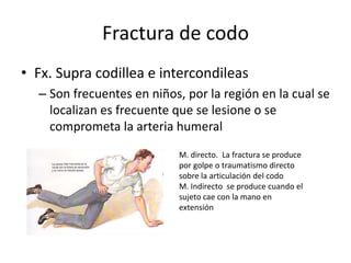 • Fx. Supra codillea e intercondileas
– Son frecuentes en niños, por la región en la cual se
localizan es frecuente que se lesione o se
comprometa la arteria humeral
Fractura de codo
M. directo. La fractura se produce
por golpe o traumatismo directo
sobre la articulación del codo
M. Indirecto se produce cuando el
sujeto cae con la mano en
extensión
 
