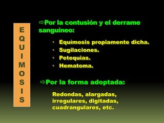 Por la contusión y el derrame
E   sanguíneo:
Q          Equímosis propiamente dicha.
U          Sugilaciones.
I          Petequias.
M          Hematoma.
O
S   Por la forma adoptada:
I       Redondas, alargadas,
S       irregulares, digitadas,
        cuadrangulares, etc.
 