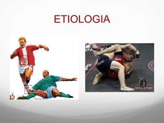 ETIOLOGIA
 