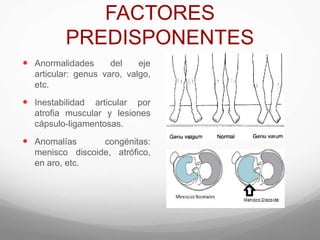 FACTORES
PREDISPONENTES
 Anormalidades del eje
articular: genus varo, valgo,
etc.
 Inestabilidad articular por
atroﬁa muscular y lesiones
cápsulo-ligamentosas.
 Anomalías congénitas:
menisco discoide, atróﬁco,
en aro, etc.
 