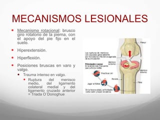 MECANISMOS LESIONALES
 Mecanismo rotacional: brusco
giro rotatorio de la pierna, con
el apoyo del pie fijo en el
suelo.
 Hiperextensión.
 Hiperflexión.
 Posiciones bruscas en varo y
valgo.
 Trauma intenso en valgo.
 Ruptura del menisco
medio, del ligamento
colateral medial y del
ligamento cruzado anterior
= Triada O´Donoghue
 