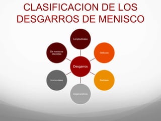 CLASIFICACION DE LOS
DESGARROS DE MENISCO
Desgarros
Longitudinales
Oblicuos
Radiales
Degenerativos
Horizontales
De meniscos
discoides
 