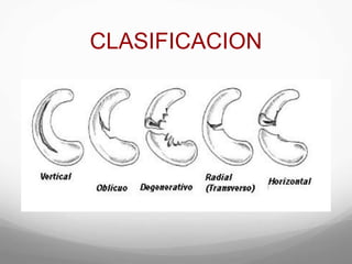 CLASIFICACION
 