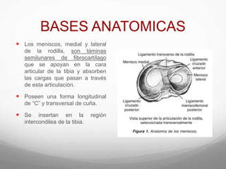 BASES ANATOMICAS
 Los meniscos, medial y lateral
de la rodilla, son láminas
semilunares de fibrocartílago
que se apoyan en la cara
articular de la tibia y absorben
las cargas que pasan a través
de esta articulación.
 Poseen una forma longitudinal
de “C” y transversal de cuña.
 Se insertan en la región
intercondilea de la tibia.
 