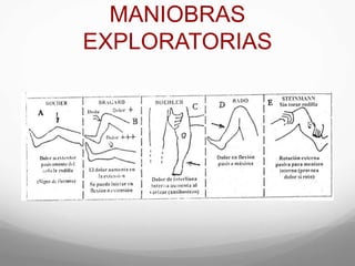 MANIOBRAS
EXPLORATORIAS
 