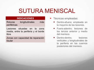 SUTURA MENISCAL
INDICACIONES
Roturas longitudinales más
periféricas
Lesiones situadas en la zona
media, entre la periferia y el borde
libre
Zonas con capacidad de reparación
tisular
 Técnicas empleadas:
 Dentro-afuera; empleada en
la mayoría de las lesiones.
 Fuera-adentro; lesiones de
los tercios anterior y medio
del menisco.
 Dentro-dentro; lesiones
verticales y longitudinales de
la periferia en los cuernos
posteriores del menisco.
 