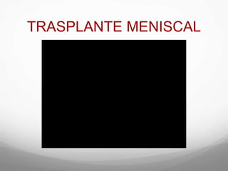 TRASPLANTE MENISCAL
 
