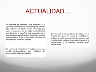 ACTUALIDAD…
 