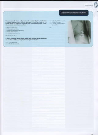 Traumatología
Casos clínicos representativos
Una adolescente de 13 años es diagnosticada de escoliosis idiopática, localizada en
el segmento torácico, y con el vértice de la curva en T7. Dicha curva es de 35° y se
muestra flexible a la exploración. El signo de Risser corresponde al grado II. El trata-
miento correcto deberá hacerse mediante:
1) Corsé de Milwaukee.
2) Observación periódica.
3) Reducción quirúrgica y artrodesis.
4) Lecho de reclinación.
5) Gimnasia exclusivamente.
MIR 97-98, 257; RC: 1
Si para el tratamiento de una fractura lumbar usted encuentra que se ha realizado
una artrodesis vertebral, señale qué criterio cumplía dicha fractura:
1) < 25° de angulación.
2) > 5 0 % de aplastamiento.
3) > 2 5 % de pérdida de calcio.
4) < 25 años de edad.
5) > 2 5 % de ocupación del ca
nal raquídeo.
RC: 2
95
 