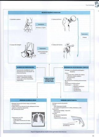Traumatología :
?
• ' i
NECROSIS ISQUÉMICA AVASCULAR
1. Escafoides carpiano 3. Cabeza del fémur
Tratamiento
Artrodesis o injerto
Tratamiento
Prótesis
2. Cuerpo del astrágalo 4. Cabeza del húmero
Tratamiento
Ortesis de descarga
o artrodesis
I
AUSENCIA DE CONSOLIDACIÓN
Ausencia de consolidación con la
formación de una "articulación" en
el foco de fractura.
Tratamiento: refrescar bordes +
injerto + osteosíntesis (atrófica
o avascular) y clavo intramedular
(hipertrófica).
COMPLICACIONES
GENERALES DE
LAS FRACTURAS
SÍNDROME DEL DOLOR REGIONAL COMPLEJO
• Etiología: inmovilización prolongada e
¡diopática.
• Clínica:
- F. aguda: dolor, rubefacción, edema
- F. distrófica: edema, rigidez y
amoratamiento
- F. atrófica
• Rx: osteoporosis moteada; posteriormente
difusa
•Tratamiento (multidisciplinar):
Fisioterapia + - Fármacos
- Bloqueos anestésicos
- Calcitonina
- Psicofármacos
- Simpatectomía
SÍNDROME DE EMBOLIA GRASA
• Etiología: fracturas de huesos largos, enclavados
intramedulares
• Cuadro clínico con intervalo lúcido, petequias en tórax
superior y conjuntiva, hipoxemia
• Rx: "tormentas de nieve"
•Tratamiento (en UCI):
- Oxigenoterapia
- Corticoides intravenosos en dosis
altas
- Estabilización precoz de la fractura
SÍNDROME COMPARTIMENTAL
• Etiología: aumento de presión
•Clínica:
- Dolor desproporcionado
- Se localiza principalmente en la tibia, antebrazo y codo
•Tratamiento:
- Apertura de vendaje + elevación
- Fasciotomía
• Secuelas:
- Retracciones importantes
porfibrosisy
malposiciones articulares
Contractura isquémica
de Volkmann
Figura 9. Esquema de las complicaciones generales de las fracturas
11
 