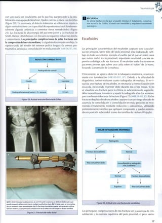 Traumatología
con yeso suele ser insuficiente, por lo que hay que proceder a la esta-
bilización con agujas de Kirschner, fijador externo o placa con tornillos
(Figura 20). En ocasiones, el defecto trabecular se rellena con injerto o
algún sustitutivo óseo con capacidad de soporte estructural (fundamen-
talmente algunas cerámicas o cementos óseos remodelables) (Figura
21). Las fracturas de alta energía del paciente joven y las fracturas de
Smith, Barton y Hutchinson con frecuencia requieren reducción abierta
y osteosíntesis. Las principales complicaciones de estas fracturas son
la compresión del nervio mediano, la algodistrofia simpaticorrefleja, la
ruptura tardía del tendón del extensor pollicis longus y la artrosis pos-
traumática asociada a consolidación en mala posición (MIR 06-07, 84).
REDUCCION CERRADA - YESO
Radiografía de control
Estable
Radiografía semanal hasta 4.a
-5.a
semana
Inestable
Cirugía
Figura 20. Actitud ante una fractura de Colles
(a) En determinadas localizaciones, la conminución ocasiona un defecto trabecular que
puede requerir relleno con injerto o algún sustitutivo óseo, (b) En este caso, se ha emplea-
do un cemento óseo remodelable. (c) En fracturas inestables puede ser necesario utilizar
fijación externa, cuya principal complicación es la infección del trayecto de los tornillos
Figura 2 1 . Fractura de radio distal
R E C U E R D A
La única fractura en la q u e se puede intentar el tratamiento conserva-
dor es en la de Colles, el resto son inestables y requieren tratamiento
quirúrgico.
Escafoides
Las principales características del escafoides carpiano son: vasculari-
zación precaria, sobre todo del polo proximal (está rodeado de cartí-
lago en todo su contorno, excepto el cuello, por el que acceden vasos
que nutren mal el tercio proximal); importante movilidad y escasa ex-
presión radiológica de sus fracturas. El escafoides suele fracturarse en
pacientes jóvenes que sufren una caída sobre el "talón" de la mano,
forzando la extensión de la muñeca.
Clínicamente, se aprecia dolor en la tabaquera anatómica, ocasional-
mente con tumefacción (MIR 00-01 F, 87). Debido a la dificultad de
diagnóstico, suelen realizarse cuatro radiografías de muñeca. Si se v i -
sualiza una fractura de escafoides, es necesaria la inmovilización con
escayola, incluyendo el primer dedo durante dos o tres meses. Si no
se visualiza una fractura, pero la clínica es suficientemente sugerente,
debe inmovilizarse la muñeca y repetir la radiografía a las dos semanas,
para confirmar o descartar la fractura (Figura 22) (MIR 09-10, 85). En las
fracturas desplazadas de escafoides carpiano (con un riesgo elevado de
ausencia de consolidación o consolidación en mala posición) se reco-
mienda el tratamiento mediante reducción y osteosíntesis, utilizando
preferentemente tornillos que apliquen compresión y queden enterra-
dos en posición subcondral (como los tornillos de Herbert-Whipple).
DOLOR EN TABAQUERA ANATÓMICA
Radiografía
Fractura de escafoides
Yeso con primer dedo
Normal
Inmovilización y radiografía
a las 2 semanas
Normal
Esguince
Fractura de escafoides
Yeso con primer dedo
Figura 22. Actitud ante una fractura de escafoides
Las principales complicaciones de esta fractura son la ausencia de con-
solidación y la necrosis isquémica del polo proximal, el peor vascu-
17
 