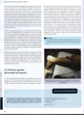 Manual CTO de Medicina y Cirugía, 8.a
edición
De las diferentes opciones de tratamiento quirúrgico, la resección de
fascia o fasciectomía es la más habitual. Esta puede ser limitada (re-
sección de pequeñas porciones de fascia afectada), regional (resec-
ción de toda la fascia afectada) o radical (extensa, resección de toda
la fascia, tanto la afectada c o m o la sana). A mayor agresividad, menor
riesgo de recidiva, pero mayor incidencia de complicaciones. La m a -
yor parte de los pacientes se tratan mediante fasciectomía regional; al
finalizar la resección, la piel puede cerrarse de forma primaria en los
casos menos graves, pero en los pacientes con contracturas más i n -
tensas, puede ser imposible cerrar la piel, pudiéndose optar por dejar
que el defecto cutáneo cierre por segunda intención (técnica de pal-
ma abierta de McCash) o cubrirlo con un injerto. En ocasiones, no es
posible recuperar la extensión de los dedos sin realizar liberaciones
capsulares asociadas.
Existen otras opciones quirúrgicas. La fasciotomía percutánea consiste
en seccionar las bandas fibrosas; se acompaña de tasas m u y elevadas
de recidiva, y únicamente se considera indicada en pacientes ancianos
con mal estado general e imposibilidad para ser sometidos a cirugía de
mayor envergadura. En pacientes con recidiva o diátesis de Dupuytren
puede estar justificada la realización de una dermofasciectomía, resec-
ción no sólo de la fascia, sino también de la piel suprayacente, seguida
de cobertura de la palma con un injerto cutáneo de espesor parcial.
En pacientes con contracturas extremas en los que, al recuperar la ex-
tensión de los dedos, se produzca isquemia por el acortamiento de las
estructuras vasculares, puede estar indicada la amputación, especial-
mente en el quinto dedo.
Las principales complicaciones del tratamiento quirúrgico de la enfer-
medad de Dupuytren son lesión de los nervios colaterales de los de-
dos, isquemia por espasmo o lesión quirúrgica, hematomas, problemas
cutáneos y de cicatrización, edema, reactivación de la enfermedad de
Dupuytren, pérdida de movilidad digital, distrofia simpaticorrefleja y
recidiva. La incidencia de complicaciones es en torno al 2 0 % , y la
de recidiva, del 2 5 % al 8 0 % , en función de la técnica empleada y las
características del paciente.
3.4. Roturas agudas
del tendón de Aquiles
La rotura aguda del tendón de Aquiles es una lesión típica de varones
de entre 30 a 50 años, deportistas ocasionales de fin de semana. La
etiología es desconocida, salvo casos de infiltraciones previas con cor-
ticoides y de ingesta prolongada de estos o de quinolonas, aunque se
debe suponer siempre la presencia de una tendinosis previa a la rotura.
La clínica se presenta c o m o un dolor intenso (similar al de recibir una
pedrada; hablándose de hecho del "signo de la pedrada"), acompa-
ñado en muchos casos de un chasquido y de impotencia funcional
para la flexión plantar activa. El diagnóstico es clínico, constatándose
la inspección de un "hachazo" cutáneo con la depresión a la palpación
en la zona típica de rotura, a unos 6-8 c m de la inserción calcánea. La
maniobra de Thompson ayuda en el diagnóstico y se realiza colocando
al paciente en decúbito prono y c o m p r i m i e n d o la masa gemelar sin
obtener una flexión plantar pasiva, al estar roto el tendón de Aquiles,
encargado de transmitir el movimiento del sistema aquíleo-calcáneo-
plantar (Figura 61). El tratamiento puede ser ortopédico (inmoviliza-
ción con yeso y/u ortesis en flexión plantar con neutralización [cambio
desde equino hasta posición plantígrada del pie con diferentes yesos
sucesivos] progresiva durante 6-8 semanas), pero el tratamiento q u i -
rúrgico (percutáneo o abierto) ofrece menores rerroturas. En ambos
tratamientos es conveniente una carga precoz en cuanto lo permita la
cicatrización tendinosa.
RECUERDA
En la lesión del tendón de Aquiles, en pacientes jóvenes y activos, el
tratamiento conservador se asocia a un elevado número de rerrupturas
y recuperación más tardía, por lo que se prefiere el tratamiento quirúr-
gico.
Figura 6 1 . Aspecto clínico típico de una rotura aguda del tendón de Aquiles.
Maniobra de T h o m p s o n (con la compresión gemelar n o se obtiene flexión
plantar pasiva)
Una enfermera de 45 años acude a nuestra consulta con un dolor muy intenso en
el hombro izquierdo, no irradiado, de 15 días de evolución, que le impide dormir.
La movilidad activa del hombro es completa, y está conservada, y es dolorosa la
palpación de la región anterior del manguito de los rotadores y de la cabeza hu-
meral. La radiografía simple es rigurosamente normal. Nuestra actitud deberá ser:
Casos clínicos representativos
1) Infiltración local de corticoide y anestésico local.
2) AINE, reposo en cabestrillo, aplicación de calor local.
3) Resonancia magnética.
4) Ecografía.
5) Electromiograma.
MIR 00-01 F, 91; RC: 2
4 4
 
