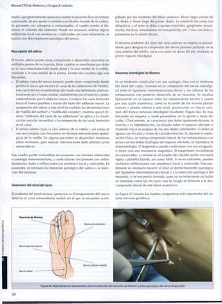 Manual CTO de Medicina y Cirugía, 8.a
edición
muslo, que generalmente aparecen cuando el paciente lleva un tiempo
caminando, de pie quieto o sentado con flexión forzada de la cadera.
En pacientes con sobrepeso o embarazadas, el cuadro remite al dis-
minuir el volumen del abdomen. Puede ser necesario realizar alguna
infiltración local con anestésicos y corticoides; en casos refractarios, se
realiza una descompresión quirúrgica del nervio.
Neuropatía del safeno
El nervio safeno puede verse c o m p r i m i d o o desarrollar neuromas en
múltiples puntos de su trayecto. Estos cuadros se manifiestan por dolor
en la cara anterolateral del muslo distal y la cara medial de la rodilla,
irradiado a la cara medial de la pierna. Existen dos cuadros algo más
frecuentes.
• El safeno, rama del nervio femoral, puede verse c o m p r i m i d o donde
perfora la fascia que recubre el canal de los adductores (de Hunter).
Este canal del tercio mediodistal del muslo está delimitado anterola-
teralmente por el vasto medial, medialmente por el sartorio y poste-
rolateralmente por el adductor mayor. Conduce los vasos femorales
hacia el hueco poplíteo a través del hiato del adductor mayor. La
compresión del safeno a este nivel ha recibido las denominaciones
de "rodilla del surfista" y "rodilla del corredor", mientras que el tér-
m i n o "síndrome del canal de los adductores" se aplica a la claudi-
cación vascular secundaria a la compresión de los vasos femorales
en el canal.
El nervio safeno cruza la cara anterior de la rodilla y sus ramas se
ven seccionadas con frecuencia en diversas intervenciones quirúr-
gicas de la rodilla. En algunos pacientes se desarrollan neuromas
sobre incisiones, para realizar intervenciones tanto abiertas c o m o
artroscópicas.
Este cuadro puede confundirse en ocasiones con lesiones meniscales
o patología femororrotuliana, y suele tratarse inicialmente con antiin-
flamatorios orales e infiltraciones con anestésico local y corticoides. En
ocasiones, es necesaria la liberación quirúrgica del safeno o la resec-
ción del neuroma.
Síndromes del túnel del tarso
panado por los tendones del tibial posterior, flexor largo común de
los dedos y flexor largo del primer dedo). La mitad de los casos son
idiopáticos y el resto se debe a quistes sinoviales, gangliones, tenosi-
novitis, fracturas consolidadas en mala posición, etc. Cursa con dolor y
parestesias en la planta del pie.
El término síndrome del túnel del tarso anterior se emplea ocasional-
mente para designar la compresión del nervio peroneo profundo en la
cara anterior del tobillo; cursa con dolor en dorso del pie, irradiado al
primer espacio interdigital.
Neuroma interdigital de Morton
Es un síndrome canalicular c o n una analogía clara con el síndrome
del túnel del carpo. Consiste en la compresión del nervio interdigi-
tal entre el ligamento intermetatarsiano dorsal y las cabezas de los
metatarsianos con posterior desarrollo de un neuroma. Se localiza
típicamente en el espacio entre los metatarsianos tercero y cuarto
por una razón anatómica, c o m o es la unión de los nervios plantar
externo y plantar interno a este nivel, provocando un mayor v o l u -
men del tronco nervioso interdigital resultante (Figura 66). Es más
frecuente en mujeres, y suele presentarse en la quinta y sexta dé-
cadas. Clínicamente, se caracteriza por dolor quemante durante la
marcha y la bipedestación, localizado sobre el espacio afectado e
irradiado hacia el pulpejo de los dos dedos colindantes. El dolor se
agrava c o n el calor y el uso de calzado estrecho. Si, durante la e x p l o -
ración física, se realiza compresión lateral de los metatarsianos o se
pinza con los dedos el pliegue del espacio afectado, se reproduce la
sintomatología. El diagnóstico puede confirmarse con una ecografía,
o mejor con una resonancia magnética. El tratamiento inicialmente
es conservador, y consiste en el empleo de calzado ancho con suela
rígida y plantilla blanda, así c o m o AINE. Si no es suficiente, pueden
realizarse infiltraciones con anestésico local y corticoide. Frecuen-
temente es necesario recurrir al final al destrechamiento quirúrgico
del ligamento intermetatasiano dorsal y a la resección quirúrgica del
neuroma, si se encuentra formado, pues no es infrecuente no hallar
un neuroma c o m o tal, en cuyo caso la cirugía se limitaría a la des-
compresión dorsal de este túnel anatómico.
El síndrome del túnel tarsiano (posterior) es el atrapamiento del nervio La Figura 6 7 resume los cuadros compresivos más importantes del sis-
tibial en el canal retromaleolar medial (en el que se encuentra acom- tema nervioso periférico.
Figura 66. Representación esquemática de la localización del neuroma de M o r t o n y pieza quirúrgica del nervio engrosado
50
 