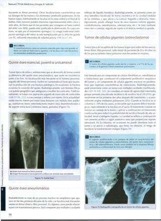 Manual CTO de Medicina y Cirugía, 8.a
edición
frecuente es fémur proximal. Otras localizaciones características son
las falanges de las manos y los elementos vertebrales posteriores. En los
huesos largos, habitualmente se localiza en la zona central o al final de la
diáfisis. Estos tumores pueden resolverse espontáneamente entre cinco y
siete años, de forma que en los pacientes que consiguen un buen control
del dolor con AINE, puede estar justificada la observación. En caso con-
trario, se opta por el tratamiento quirúrgico. La cirugía tradicional (extir-
pación quirúrgica del nidus) se está reemplazando por la ablación guiada
con TC, utilizando electrodos de radiofrecuencia (MIR 06-07, 89).
rellenas de líquido hemático. Radiológicamente, se presenta c o m o un
área osteolítica localizada de forma excéntrica en la cavidad medular
de las metáfisis, y que afecta a la cortical, llegando a destruirla. Histo-
lógicamente, puede albergar focos de otros tumores (células gigantes,
condroblastoma, osteoblastoma, osteosarcoma, etc.). Se trata mediante
resección o curetaje, seguido de injerto si el defecto residual es grande.
Tumor de células gigantes (osteoclastoma)
Q R E C U E R D A
El osteoblastoma es c o m o un osteoma osteoide pero algo más grande; el
dolor no cede tan bien c o n la aspirina, y se localiza c o n más frecuencia
en elementos vertebrales posteriores.
Tumor típico de las epífisis de los huesos largos (por orden de frecuencia,
fémur distal, tibia proximal, radio distal) de pacientes de 20 a 4 0 años. Es
de los pocos tumores óseos primarios más frecuentes en mujeres.
Quiste óseo esencial, juvenil o unicameral
Tumor típico de niños y adolescentes que se desarrolla de forma central
(a diferencia del quiste óseo aneurismático, que suele ser excéntrico)
junto a las fisis. Su localización más frecuente es el húmero proximal,
seguido del fémur proximal. Suelen ser asintomáticos hasta que ocasio-
nan la producción de una fractura patológica. En ocasiones, la fractura
ocasiona la curación del quiste. Radiológicamente, son lesiones líticas
con patrón geográfico que adelgazan e insuflan las corticales. Tradicio-
nalmente, se tratan con aspiración seguida de inyección de corticoides
(MIR 97-98, 222), o con curetaje y relleno con injerto. En la actualidad,
existe mucho interés por tratar estas lesiones con médula ósea autólo-
ga, sustitutivos óseos osteoinductores (matriz ósea desmineralizada) o
de soporte estructural (cementos óseos, granulos) (Figura 73).
(a) Quiste óseo esencial en fémur proximal
(b) Imagen fluoroscópica tras la aspiración y relleno con cemento óseo remodelable
Figura 73. Quiste óseo
Quiste óseo aneurismático
Probablemente se trata de un proceso reactivo no neoplásico que apa-
rece en las dos primeras décadas de la vida y se localiza más frecuente-
mente en fémur distal y tibia proximal. En algunos casos puede relacio-
narse con traumatismos previos. Está compuesto por múltiples cavidades
R E C U E R D A
El t u m o r de células gigantes suele afectar a mujeres, y el 1 % de los pa-
cientes al diagnóstico tiene metástasis pulmonares.
Está formado por un componente de células fibroblásticas, osteoblásticas
e histiocitarias que constituyen el componente proliferativo neoplásico
del tumor y un componente de células gigantes reactivas no prolifera-
tivas que expresan características de osteoclastos. Radiológicamente,
suele presentarse c o m o un tumor con múltiples cavidades (multilocula-
do) (MIR 98-99F, 103). Se considera un tumor de agresividad intermedia
porque presenta una elevada incidencia de recidiva local (10-25%), ge-
neralmente en los primeros dos años después del tratamiento, y ocasio-
nalmente origina metástasis pulmonares ( 2 % ) . Cuando se localiza en la
columna (< 1 0 % de los casos), es frecuente que ocasione déficit neuroló-
gicos, especialmente si se localiza en el sacro. El tratamiento consiste en
realizar un curetaje de la lesión y aplicar a continuación un tratamiento
coadyuvante para reducir la probabilidad de recidiva (fresado de alta ve-
locidad, fenol o nitrógeno líquido). La cavidad se rellena a continuación
con cemento acrílico o algún sustitutivo óseo que proporcione soporte
estructural. En la columna, en ocasiones no puede abordarse todo el
tumor y se asocia a radioterapia, que tiene, no obstante, el riesgo de
favorecer la transformación maligna (Figura 74).
R E C U E R D A
El aspecto m u l t i l o c u l a d o o en pompas de jabón es característico del
t u m o r de células gigantes u osteoclastoma, del quiste óseo aneurismá-
tico y del a d a m a n t i m o m a . Puede verse también en la displasia fibrosa
poliostótica o enfermedad de McCune-Albright.
5 6
 