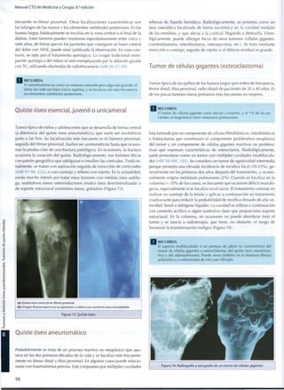 Manual CTO de Medicina y Cirugía, 8.a
edición
frecuente es fémur proximal. Otras localizaciones características son
las falanges de las manos y los elementos vertebrales posteriores. En los
huesos largos, habitualmente se localiza en la zona central o al final de la
diáfisis. Estos tumores pueden resolverse espontáneamente entre cinco y
siete años, de forma que en los pacientes que consiguen un buen control
del dolor con AINE, puede estar justificada la observación. En caso con-
trario, se opta por el tratamiento quirúrgico. La cirugía tradicional (extir-
pación quirúrgica del nidus) se está reemplazando por la ablación guiada
con TC, utilizando electrodos de radiofrecuencia (MIR 06-07, 89).
rellenas de líquido hemático. Radiológicamente, se presenta c o m o un
área osteolítica localizada de forma excéntrica en la cavidad medular
de las metáfisis, y que afecta a la cortical, llegando a destruirla. Histo-
lógicamente, puede albergar focos de otros tumores (células gigantes,
condroblastoma, osteoblastoma, osteosarcoma, etc.). Se trata mediante
resección o curetaje, seguido de injerto si el defecto residual es grande.
Tumor de células gigantes (osteoclastoma)
Q R E C U E R D A
El osteoblastoma es c o m o un osteoma osteoide pero algo más grande; el
dolor no cede tan bien c o n la aspirina, y se localiza c o n más frecuencia
en elementos vertebrales posteriores.
Tumor típico de las epífisis de los huesos largos (por orden de frecuencia,
fémur distal, tibia proximal, radio distal) de pacientes de 20 a 4 0 años. Es
de los pocos tumores óseos primarios más frecuentes en mujeres.
Quiste óseo esencial, juvenil o unicameral
Tumor típico de niños y adolescentes que se desarrolla de forma central
(a diferencia del quiste óseo aneurismático, que suele ser excéntrico)
junto a las fisis. Su localización más frecuente es el húmero proximal,
seguido del fémur proximal. Suelen ser asintomáticos hasta que ocasio-
nan la producción de una fractura patológica. En ocasiones, la fractura
ocasiona la curación del quiste. Radiológicamente, son lesiones líticas
con patrón geográfico que adelgazan e insuflan las corticales. Tradicio-
nalmente, se tratan con aspiración seguida de inyección de corticoides
(MIR 97-98, 222), o con curetaje y relleno con injerto. En la actualidad,
existe mucho interés por tratar estas lesiones con médula ósea autólo-
ga, sustitutivos óseos osteoinductores (matriz ósea desmineralizada) o
de soporte estructural (cementos óseos, granulos) (Figura 73).
(a) Quiste óseo esencial en fémur proximal
(b) Imagen fluoroscópica tras la aspiración y relleno con cemento óseo remodelable
Figura 73. Quiste óseo
Quiste óseo aneurismático
Probablemente se trata de un proceso reactivo no neoplásico que apa-
rece en las dos primeras décadas de la vida y se localiza más frecuente-
mente en fémur distal y tibia proximal. En algunos casos puede relacio-
narse con traumatismos previos. Está compuesto por múltiples cavidades
R E C U E R D A
El t u m o r de células gigantes suele afectar a mujeres, y el 1 % de los pa-
cientes al diagnóstico tiene metástasis pulmonares.
Está formado por un componente de células fibroblásticas, osteoblásticas
e histiocitarias que constituyen el componente proliferativo neoplásico
del tumor y un componente de células gigantes reactivas no prolifera-
tivas que expresan características de osteoclastos. Radiológicamente,
suele presentarse c o m o un tumor con múltiples cavidades (multilocula-
do) (MIR 98-99F, 103). Se considera un tumor de agresividad intermedia
porque presenta una elevada incidencia de recidiva local (10-25%), ge-
neralmente en los primeros dos años después del tratamiento, y ocasio-
nalmente origina metástasis pulmonares ( 2 % ) . Cuando se localiza en la
columna (< 1 0 % de los casos), es frecuente que ocasione déficit neuroló-
gicos, especialmente si se localiza en el sacro. El tratamiento consiste en
realizar un curetaje de la lesión y aplicar a continuación un tratamiento
coadyuvante para reducir la probabilidad de recidiva (fresado de alta ve-
locidad, fenol o nitrógeno líquido). La cavidad se rellena a continuación
con cemento acrílico o algún sustitutivo óseo que proporcione soporte
estructural. En la columna, en ocasiones no puede abordarse todo el
tumor y se asocia a radioterapia, que tiene, no obstante, el riesgo de
favorecer la transformación maligna (Figura 74).
| R E C U E R D A
El aspecto m u l t i l o c u l a d o o en pompas de jabón es característico del
t u m o r de células gigantes u osteoclastoma, del quiste óseo aneurismá-
tico y del a d a m a n t i m o m a . Puede verse también en la displasia fibrosa
poliostótica o enfermedad de McCune-Albright.
Figura 74. Radiografía y xerografía de un t u m o r de células gigantes
5 6
 