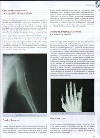 Traumatología
Osteocondroma (exóstosis)
y exóstosis hereditaria múltiple
Es el tumor óseo benigno más frecuente. Se interpreta c o m o una zona
de la fisis que se independiza y genera una formación ósea recubierta
por un caperuzón cartilaginoso. Suele diagnosticarse en la infancia,
aunque su existencia puede pasar desapercibida hasta la edad adulta.
Radiológicamente, tiene el aspecto de una excrecencia sésil o pedicu-
lada. Generalmente deja de crecer cuando acaba el crecimiento y se
cierran las fisis. Si la lesión'no ocasiona síntomas por su prominencia
(compresión vasculonerviosa, irritación local con bursitis, resaltes ten-
dinosos o musculares), no requiere tratamiento (MIR 99-00, 125). En
caso contrario, se trata mediante resección; conviene retrasar la cirugía
hasta acabado el crecimiento para (1) reducir la incidencia de recidiva
y (2) no ocasionar lesiones iatrogénicas en las fisis adyacentes. Si un os-
teocondroma continúa creciendo en la edad adulta, debe sospecharse
su transformación maligna, más frecuente en pacientes con una altera-
ción autosómica dominante denominada exóstosis u osteocondroma-
tosis hereditaria múltiple (Figura 75).
Figura 75. Osteocondroma d e húmero
Condroblastoma
Tumores típicos de la segunda década de la vida (casi exclusivos de
los adolescentes) que se sitúan centralmente en las epífisis de fémur
distal, tibia proximal y húmero proximal. La mayor parte de los pa-
cientes tienen dolor, y algunos de ellos limitación de la movilidad o
derrame articular. Radiológicamente, aparecen c o m o lesiones líticas
situadas en el interior del hueso. Tienen tendencia a atravesar la fisis y
pueden ocasionar destrucción articular. Un tercio de los casos presenta
calcificaciones en su interior. Debido a su agresividad local y tendencia
a la recidiva, el tratamiento consiste en realizar un curetaje de la lesión,
seguido de tratamiento adyuvante local (fenol o nitrógeno líquido) y re-
lleno con injerto o sustitutivos óseos. Los condroblastomas en torno a la
pelvis son especialmente agresivos, presentando mayor tendencia a
la recidiva. Se han descrito casos aislados de metástasis.
Condroma, enfermedad de Ollier
y síndrome de Maffucci
Tumor formado por tejido cartilaginoso maduro que habitualmente se
localiza ¡ntramedularmente en huesos tubulares (encondroma), aun-
que ocasionalmente puede localizarse en la superficie ósea (se habla
entonces de condroma perióstico). La localización más frecuente del
encondroma la constituyen las falanges de las manos. Generalmen-
te son asintomáticos, a menos que ocasionen una fractura patológica.
Como otros tumores de estirpe condral, suelen presentar calcificacio-
nes centrales. Unicamente requieren observación, aunque las lesiones
más grandes y lasv
que producen fracturas patológicas pueden tratar-
se mediante curetaje e injerto. La aparición de múltiples condromas
(condromatosis múltiple) representa una displasia ósea caracterizada
por una alteración del proceso de osificación endocondral normal
que ocasiona múltiples masas cartilaginosas con incurvación y acorta-
miento de los huesos. Cuando la condromatosis es m u y extensa y tiene
predilección unilateral, se denomina enfermedad de Ollier (Figura 76).
Cuando se asocia con angiomas en las partes blandas, se denomina
síndrome de Maffucci. En estos tres cuadros, existe un mayor riesgo de
malignización de los condromas.
Figura 76. Encondromatosis múltiple
Condrosarcoma
Tumor maligno típico de pacientes entre la quinta y séptima década de
la vida, caracterizado por un crecimiento lento, pero una gran tenden-
cia a presentar recidivas. Sus localizaciones más frecuentes son pelvis,
fémur proximal y húmero proximal; es excepcional que ocurra en la
parte distal de las extremidades.
5 7
 