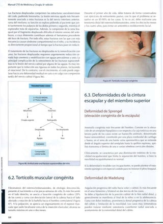 Manual CTO de Medicina y Cirugía, 8.a
edición
Las fracturas desplazadas comprimen las estructuras vasculonerviosas
del codo, pudiendo lesionarlas. La lesión nerviosa aguda más frecuen-
temente asociada a estas fracturas es la del nervio interóseo anterior,
rama del mediano; su función se explora pidiendo al paciente que j u n -
te fuertemente los pulpejos de los dedos primero y segundo, mientras el
explorador trata de separarlos. Además, la compresión de la vena bra-
quial por el fragmento desplazado dificulta el retorno venoso del ante-
brazo, a cuya distensión contribuye además el hematoma procedente
del foco de fractura. Por todo ello, estas fracturas son las que con más
frecuencia causan síndrome compartimental en el niño, y su incidencia
es directamente proporcional al tiempo que la fractura pase sin reducir.
El tratamiento de las fracturas no desplazadas es la inmovilización con
yeso; las fracturas desplazadas requieren urgentemente reducción ce-
rrada bajo anestesia y estabilización con agujas percutáneas y yeso. La
principal complicación de la osteosíntesis de las fracturas supracondí-
leas es la lesión del nervio cubital por alguna de las agujas. Es m u y i m -
portante que la reducción sea rigurosa en todos los planos, incluyendo
el rotacional. De lo contrario, con el crecimiento, el codo puede angu-
larse hacia una deformidad residual en varo o en valgo con compresión
tardía del nervio cubital (Figura 86).
TRAUMATISMO CODO
I
1." PULSO RADIAL
2 ° Pulso cubital
NEGATIVO POSITIVO
Cirugía urgente Radiografía
Desplazada No desplazada
Agujas Yeso
CUIDADO
Compresión
cubital tardía
Figura 86. Actitud ante una fractura supracondílea del niño
6.2.Tortícol¡s muscular congénita
Durante el primer año de vida, debe tratarse de forma conservadora
con ejercicios de estiramiento pasivo, con lo que el problema se re-
suelve en un 8 5 - 9 0 % de los casos. Si no es así, debe realizarse una
tenotomía distal del esternocleidomastoideo, entre los dieciocho meses
y los cuatro años, para evitar un antiestético moldeamiento facial.
Figura 87.Tortícolis muscular congénita
6.3. Deformidades de la cintura
escapular y del miembro superior
Deformidad de Sprengel
(elevación congénita de la escápula)
Anomalía congénita más frecuente del hombro. Consiste en la eleva-
ción de un omóplato hipoplásico con respecto a la caja torácica; en una
tercera parte de los casos existe un huesecillo anómalo, denominado
hueso omovertebral, constituido por una placa romboidal de cartílago
y hueso, en el seno de una fuerte vaina aponeurótica que se extiende
desde el ángulo superior del omóplato hasta la apófisis espinosa, apó-
fisis transversa o lámina de una o varias vértebras cervicales distales.
Clínicamente, se caracteriza por una disminución indolora de la m o -
vilidad escapulocostal que limita la separación del hombro, si bien la
movilidad escapulohumeral es normal.
Si la deformidad e invalidez son incapacitantes, se puede plantear el trata-
miento quirúrgico con especial cuidado para no lesionar el plexo braquial.
Deformidad de Madelung
Fibromatosis del esternocleidomastoideo, de etiología desconocida,
presente al nacimiento o a las pocas semanas de vida. Es más frecuente
en el lado derecho, se asocia a luxación congénita de cadera ( 2 0 %
de los casos) y cursa con desviación lateral de la cabeza hacia el lado
afectado y rotación de la barbilla hacia el hombro contralateral (Figura
87). A la palpación, se aprecia un engrasamiento en el espesor mus-
cular que suele localizarse cerca de la inserción clavicular; alcanza su
tamaño máximo en uno o dos meses.
Angulación progresiva del radio hacia volar y cubital. Es más frecuente
en el sexo femenino y bilateral en dos tercios de los casos.
Se debe a hipofunción de la porción cubital de la fisis radial distal, y
generalmente se manifiesta al final de la niñez o en la adolescencia.
Cursa con dolor insidioso, prominencia dorsal progresiva de la cabeza
del cubito y limitación de la movilidad. Los casos m u y sintomáticos
pueden tratarse mediante osteotomía cuneiforme radial asociada a
acortamiento de la extremidad distal del cubito.
6 4
 