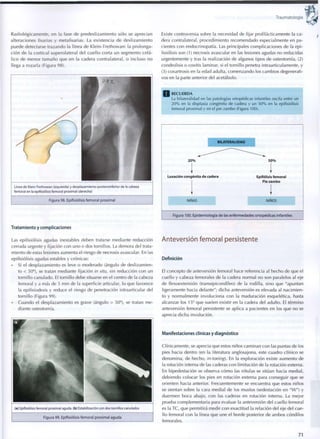 Traumatología
Radiológicamente, en la fase de predeslizamiento sólo se aprecian
alteraciones fisarias y metafisarias. La existencia de deslizamiento
puede detectarse trazando la línea de Klein-Trethowan: la prolonga-
ción de la cortical superolateral del cuello corta un segmento cefá-
lico de menor tamaño que en la cadera contralateral, o incluso no
llega a rozarla (Figura 98).
Línea de Klein-Trethowan (izquierda) y desplazamiento posteroinferior de la cabeza
femoral en la epifisiólisis femoral proximal (derecha)
Figura 98. Epifisiólisis femoral proximal
Tratamiento y complicaciones
Las epifisiólisis agudas inestables deben tratarse mediante reducción
cerrada urgente y fijación con uno o dos tornillos. La demora del trata-
miento de estas lesiones aumenta el riesgo de necrosis avascular. En las
epifisiólisis agudas estables y crónicas:
• Si el desplazamiento es leve o moderado (ángulo de deslizamien-
to < 50°), se tratan mediante fijación in situ, sin reducción con un
tornillo canulado. El tornillo debe situarse en el centro de la cabeza
femoral y a más de 5 m m de la superficie articular, lo que favorece
la epifisiodesis y reduce el riesgo de penetración intraarticular del
tornillo (Figura 99).
• Cuando el desplazamiento es grave (ángulo > 50°), se tratan me-
diante osteotomía.
(a) Epifisiólisis femoral proximal aguda, (b) Estabilización con dos tornillos canulados
Figura 99. Epifisiólisis femoral proximal aguda
Existe controversia sobre la necesidad de fijar profilácticamente la ca-
dera contralateral, procedimiento recomendado especialmente en pa-
cientes con endocrinopatía. Las principales complicaciones de la epi-
fisiólisis son (1) necrosis avascular en las lesiones agudas no reducidas
urgentemente y tras la realización de algunos tipos de osteotomía, (2)
condrolisis o coxitis laminar, si el tornillo penetra intraarticulamente, y
(3) coxartrosis en la edad adulta, comenzando los cambios degenerati-
vos en la parte anterior del acetábulo.
RECUERDA
La bilateralidad en las patologías ortopédicas infantiles oscila entn
2 0 % en la displasia congénita de cadera y un 5 0 % en la epifisiólisis
femoral p r oxima l y en el pie z a m b o (Figura 100).
BILATERALIDA
2 0 %
Luxación congénita de cadera
NINAS
5 0 %
Epifólisis femoral
Pie zambo
NIÑOS
Figura 100. Epidemiología de las enfermedades ortopédicas infantiles
Anteversión femoral persistente
Definición
El concepto de anteversión femoral hace referencia al hecho de que el
cuello y cabeza femorales de la cadera normal no son paralelos al eje
de flexoextensión (transepicondíleo) de la rodilla, sino que "apuntan
ligeramente hacia delante"; dicha anteversión es elevada al nacimien-
to y normalmente involuciona con la maduración esquelética, hasta
alcanzar los 15° que suelen existir en la cadera del adulto. El término
anteversión femoral persistente se aplica a pacientes en los que no se
aprecia dicha involución.
Manifestaciones clínicas y diagnóstico
Clínicamente, se aprecia que estos niños caminan con las puntas de los
pies hacia dentro (en la literatura anglosajona, este cuadro clínico se
denomina, de hecho, in-toeing). En la exploración existe aumento de
la rotación interna de las caderas con limitación de la rotación externa.
En bipedestación se observa cómo las rótulas se sitúan hacia medial,
debiendo colocar los pies en rotación externa para conseguir que se
orienten hacia anterior. Frecuentemente se encuentra que estos niños
se sientan sobre la cara medial de los muslos (sedestación en "W") y
duermen boca abajo, con las caderas en rotación interna. La mejor
prueba complementaria para evaluar la anteversión del cuello femoral
es la TC, que permitirá medir con exactitud la relación del eje del cue-
llo femoral con la línea que une el borde posterior de ambos cóndilos
femorales.
71
 
