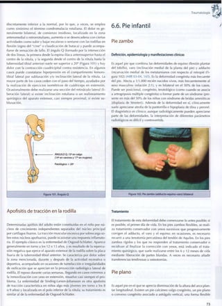 Traumatología
discretamente inferior a la normal, por lo que, a veces, se emplea
c o m o sinónimo el término condromalacia rotuliana. El dolor es ge-
neralmente bilateral, de c o m i e n z o insidioso, localizado en la zona
anteromedial o retrorrotuliano, aumenta o se desencadena c o n ciertas
actividades c o m o subir y bajar escaleras o sentarse c o n las rodillas en
flexión (signo del " c i n e " o claudicación de butaca) y puede acompa-
ñarse de sensación de fallo. El ángulo Q (formado por la intersección
de dos líneas, la primera desde la espina ilíaca anterosuperior hasta el
centro de la rótula, y la segunda desde el centro de la rótula hasta la
tuberosidad tibial anterior) suele ser superior a 20° (Figura 101) y hay
dolor con la contracción cuadricipital contra resistencia. En algunos
casos puede constatarse hiperpresión en el compartimento femoro-
tibial lateral por subluxación y/o inclinación lateral de la rótula. La
mayor parte de los casos ceden con el paso del tiempo, ayudados por
la realización de ejercicios isométricos de cuadríceps en extensión.
Ocasionalmente debe realizarse una sección del retináculo lateral ( l i -
beración lateral) si existe inclinación rotuliana o un realineamiento
quirúrgico del aparato extensor, casi siempre p r o x i m a l , si existe su-
bluxación.
i
 ÁNGULO Q: 15° en valgo
 , (14° en varones y 17o
en mujeres)
y  Patológico: > 20°
Figura 101. Ángulo Q
Apofisitis de tracción en la rodilla
Determinadas apófisis del adulto están constituidas en el niño por nú-
cleos de crecimiento independientes separados del núcleo principal
por cartílagos fisarios. La tracción muscular excesiva por sobrecarga so-
bre estos núcleos apofisarios, puede ocasionar una respuesta inflamato-
ria. El ejemplo clásico es la enfermedad de Osgood-Schlatter. Aparece
generalmente en torno a los 12 o 13 años, y es resultado de la repercu-
sión negativa que ejerce el aparato extensor de la rodilla sobre la placa
fisaria de la tuberosidad tibial anterior. Se caracteriza por dolor sobre
la zona mencionada, durante y después de la actividad recreativa o
deportiva, acompañado en ocasiones de tumefacción e irregularidades
de osificación que se aprecian en la proyección radiológica lateral de
rodilla. El reposo durante varias semanas, llegando en casos extremos a
la inmovilización con yeso en extensión, resuelve casi siempre el pro-
blema. La enfermedad de Sinding-Larsen-Johansson es otra apofisitis
de tracción característica en niños algo más jóvenes (en torno a los 8
o 9 años) y localizada en el polo inferior de la rótula; su tratamiento es
similar al de la enfermedad de Osgood-Schlatter.
6.6. Pie infantil
Pie zambo
Definición, epidemiología y manifestaciones clínicas
Es aquel pie que combina las deformidades de equino (flexión plantar
del tobillo), varo (inclinación medial de la planta del pie) y adducto
(incurvación medial de los metatarsianos con respecto al retropié (Fi-
gura 102) (MIR 03-04, 165). Es la deformidad congénita más frecuente
del pie. Afecta a 1/1.000 recién nacidos vivos, más frecuentemente al
sexo masculino (relación 2:1), y es bilateral en el 5 0 % de los casos.
Puede ser posicional, congénito, teratológico (como cuando se asocia
a artrogriposis múltiple congénita) o formar parte de un síndrome (pre-
sente en más del 5 0 % de los niños con síndrome de bridas amnióticas
[displasia de Streeterj). Además de la deformidad en sí, clínicamente
suele apreciarse atrofia de la pantorrilla e hipoplasia de tibia y peroné.
El diagnóstico es clínico; aunque radiológicamente pueden apreciarse
parte de las deformidades, la interpretación de diferentes parámetros
radiológicos es difícil y controvertida.
Figura 102. Pie z a m b o (adducto-equino-varo) bilateral
Tratamiento
El tratamiento de esta deformidad debe comenzarse lo antes posible; si
es posible, el primer día de vida. En los pies zambos flexibles, se reali-
za tratamiento conservador con yesos sucesivos que progresivamente
corrigen el adducto, el varo y el equino; en ocasiones, es necesario
recurrir a una tenotomía percutánea del tendón de Aquiles. En los pies
zambos rígidos y los que no responden al tratamiento conservador o
recidivan al finalizar la corrección con yesos, está indicado el trata-
miento quirúrgico, que suele realizarse entre los 6 y 12 meses de vida
mediante liberación de partes blandas. A veces es necesario añadir
transferencias tendinosas u osteotomías.
Pie plano
Es aquel pie en el que se aprecia disminución de la altura del arco plan-
tar longitudinal. Existen un pie calcáneo valgo congénito, un pie plano
o convexo congénito asociado a astrágalo vertical, una forma flexible
73
 