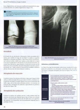 Manual CTO de Medicina y Cirugía, 8.a
edición
ticas o degenerativas, así c o m o para modificar la transmisión de cargas
en articulaciones c o n cambios degenerativos (Figura 107).
Q RECUERDA
Las indicaciones más frecuentes de osteotomía son la de tibia valguizan-
te e n el genu varo degenerativo y del p r i m e r metatarsiano en el hallux
valgus doloroso.
Figura 107. Varón d e 45 años con gonartrosis medial aislada
tratado con osteotomía valguizante de tibia fijada con una grapa metálica
Artrodesis
Es la fusión de una articulación, eliminando el dolor procedente de la
misma, pero también el rango de movilidad. Se emplea en aquellos
diagnósticos (artropatía neuropática, infecciones activas) o localizacio-
nes (columna lumbar, tobillo, pie, muñeca, primer dedo de la mano)
en los que se puede fijar la articulación en una posición funcional y no
existen otras alternativas, especialmente si el paciente necesita usar de
forma m u y activa el miembro afectado (trabajadores manuales, pacien-
tes jóvenes, etc.). Debe evitarse la realización de artrodesis cuando se
afectan articulaciones de forma bilateral o simétrica.
Artroplastia de resección
Consiste en resecar ios extremos articulares y dejar que el espacio entre
ambos se rellene de tejido fibroso para reducir el dolor y mantener cier-
to grado de movilidad. Se emplea algunas veces para el tratamiento del
hallux valgus, de las infecciones articulares activas y, en ocasiones, en
el fracaso de la artroplastia de sustitución, especialmente en presencia
de infección (Figura 108).
Artroplastia de sustitución
Consiste en sustituir uno (prótesis parcial) o todos (prótesis total) los
extremos articulantes por implantes que se fijan al hueso c o n cemento
acrílico, o favoreciendo la penetración de tejido óseo en la superficie
del implante. Es el tratamiento más frecuentemente empleado para la
patología articular.
Figura 108. Artroplastia d e resección en la articulación coxofemoral
(técnica de Girdlestone)
Indicaciones y contraindicaciones
La Tabla 2 0 recoge las principales indicaciones actuales de la artro-
plastia de sustitución. Las principales contraindicaciones son infec-
ción activa y artropatía neuropática de Charcot (Figura 109) (MIR 98-
99F, 106).
FRACTURAS
PATOLOGIA
ARTICULAR
TUMORES
Fractura desplazada cuello femoral edad avanzada
Fractura húmero proximal (4 fragmentos, destrucción
cefálica, edad avanzada + luxación o 3 fragmentos)
Fractura supraintracondílea húmero distal si edad avanzada
o patología previa
Artrosis (cadera, rodilla, h o m b r o , codo)
- Primaria
- Secundarla (enfermedades pediátricas [displasia,
Perthes, epifisiólisis], artrosis postraumática, Paget, etc.)
Enfermedades inflamatorias c o m o la artritis reumatoide
(cadera, rodilla, h o m b r o , codo, muñeca, dedos de la mano)
Osteonecrosis del adulto (cadera, rodilla, hombro)
Otras (sinovitis villonodular pigmentada c o n destrucción
articular, artrodesis previa con mala función o afectación
de otras articulaciones, artroplastia de resección previa,
etc.)
Reconstrucción tras la resección del t u m o r en cirugía
de preservación del m i e m b r o
Tabla 20. Principales indicaciones de la artroplastia
de sustitución articular
7 8
 