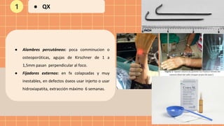 ● Alambres percutáneos: poca comminucion o
osteoporóticas, agujas de Kirschner de 1 a
1,5mm pasan perpendicular al foco.
● Fijadores externos: en fx colapsadas y muy
inestables, en defectos óseos usar injerto o usar
hidroxiapatita, extracción máximo 6 semanas.
1 ● QX
 