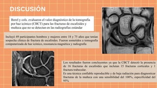 Incluyó 49 participantes hombres y mujeres entre 18 y 75 años que tenían
sospecha clínica de fractura de escafoides. Fueron sometidos a tomografía
computarizada de haz icónico, resonancia magnética y radiografía
Borel y cols. evaluaron el valor diagnóstico de la tomografía
por haz icónico (CBCT) para las fracturas de escafoides y
muñeca que no se detectan en las radiografías estándar
DISCUSIÓN
Los resultados fueron concluyentes ya que la CBCT detectó la presencia
de 16 fracturas de escafoides que incluían 15 fracturas corticales y 1
fractura trabecular.
Es una técnica confiable reproducible y de baja radiación para diagnosticar
fracturas de la muñeca con una sensibilidad del 100%, especificidad del
95%
 