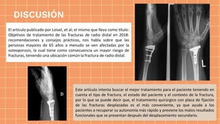 Este artículo intenta buscar el mejor tratamiento para el paciente teniendo en
cuenta el tipo de fractura, el estado del paciente y el contexto de la fractura,
por lo que se puede decir que, el tratamiento quirúrgico con placa de fijación
de las fracturas desplazadas es el más conveniente, ya que ayuda a los
pacientes a recuperar su autonomía más rápido y previene los malos resultados
funcionales que se presentan después del desplazamiento secundario.
El artículo publicado por Loisel, et al; el mismo que lleva como título:
Objetivos de tratamiento de las fracturas de radio distal en 2018:
recomendaciones y consejos prácticos, nos habla sobre que las
personas mayores de 65 años a menudo se ven afectadas por la
osteoporosis, la cual tiene como consecuencia un mayor riesgo de
fracturas, teniendo una ubicación común la fractura de radio distal.
DISCUSIÓN
 