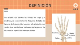 Son lesiones que afectan los huesos del carpo y el
antebrazo, se considera la más frecuente de todas las
fracturas de la extremidad superior, y la afectación más
común sigue siendo la de los huesos de la primera fila
del carpo, en especial del hueso escafoides.
DEFINICIÓN
 