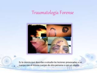 Traumatología Forense
Es la ciencia que describe o estudia las lesiones provocadas a un
cuerpo con el mismo cuerpo de otra persona o con un objeto.
 