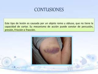 TRAUMATOLOGIA FORENSE MEDICINA LEGAL | PPTX
