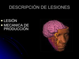 DESCRIPCIÓN DE LESIONES LESIÓN MECANICA DE PRODUCCIÓN 