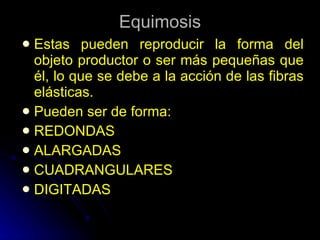 Equimosis Estas pueden reproducir la forma del objeto productor o ser más pequeñas que él, lo que se debe a la acción de las fibras elásticas. Pueden ser de forma: REDONDAS ALARGADAS CUADRANGULARES DIGITADAS 