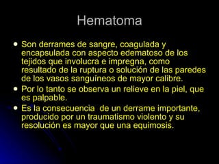 Hematoma Son derrames de sangre, coagulada y encapsulada con aspecto edematoso de los tejidos que involucra e impregna, como resultado de la ruptura o solución de las paredes de los vasos sanguíneos de mayor calibre. Por lo tanto se observa un relieve en la piel, que es palpable. Es la consecuencia  de un derrame importante, producido por un traumatismo violento y su resolución es mayor que una equimosis. 