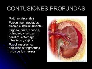 CONTUSIONES PROFUNDAS Roturas viscerales Pueden ser afectados directa o indirectamente. Hígado, bazo, riñones, pulmones y corazón, cerebro, estómago, intestinos y vejiga. Papel importante: esquirlas o fragmentos rotos de los huesos. 