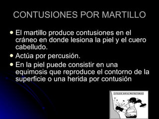 CONTUSIONES POR MARTILLO El martillo produce contusiones en el cráneo en donde lesiona la piel y el cuero cabelludo. Actúa por percusión. En la piel puede consistir en una equimosis que reproduce el contorno de la superficie o una herida por contusión 