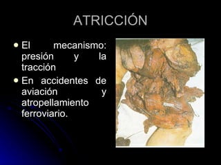 ATRICCIÓN El mecanismo: presión y la tracción En accidentes de aviación y atropellamiento ferroviario. 