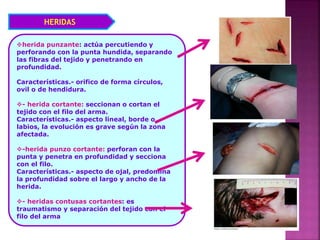 .HERIDAS
herida punzante: actúa percutiendo y
perforando con la punta hundida, separando
las fibras del tejido y penetrando en
profundidad.
Características.- orifico de forma círculos,
ovil o de hendidura.
- herida cortante: seccionan o cortan el
tejido con el filo del arma.
Características.- aspecto lineal, borde o
labios, la evolución es grave según la zona
afectada.
-herida punzo cortante: perforan con la
punta y penetra en profundidad y secciona
con el filo.
Características.- aspecto de ojal, predomina
la profundidad sobre el largo y ancho de la
herida.
- heridas contusas cortantes: es
traumatismo y separación del tejido con el
filo del arma
 