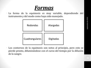 Formas
• La forma de la equimosis es muy variable, dependiendo del
instrumento y del modo como haya sido manejado.
• Los contornos de la equimosis son netos al principio, pero esto se
pierde pronto, difuminándose con el curso del tiempo por la difusión
de la sangre.
Redondas Alargadas
Cuadrangulares Digitadas
septiembrede2015
38
 