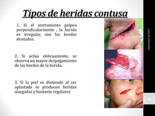 Tipos de heridas contusa
1. Si el instrumento golpea
perpendicularmente , la herida
es irregular, con los bordes
dentados.
2. Si actúa oblicuamente, se
observa un mayor despegamiento
de los bordes de la herida.
3. Si la piel se distiende al ser
aplastada se producen heridas
alargadas y bastante regulares
septiembrede2015
44
 