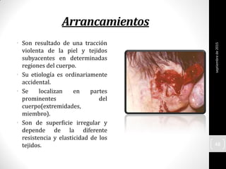 Arrancamientos
• Son resultado de una tracción
violenta de la piel y tejidos
subyacentes en determinadas
regiones del cuerpo.
• Su etiología es ordinariamente
accidental.
• Se localizan en partes
prominentes del
cuerpo(extremidades,
miembro).
• Son de superficie irregular y
depende de la diferente
resistencia y elasticidad de los
tejidos.
septiembrede2015
48
 