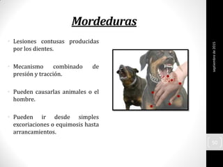 Mordeduras
• Lesiones contusas producidas
por los dientes.
• Mecanismo combinado de
presión y tracción.
• Pueden causarlas animales o el
hombre.
• Pueden ir desde simples
excoriaciones o equimosis hasta
arrancamientos.
septiembrede2015
50
 